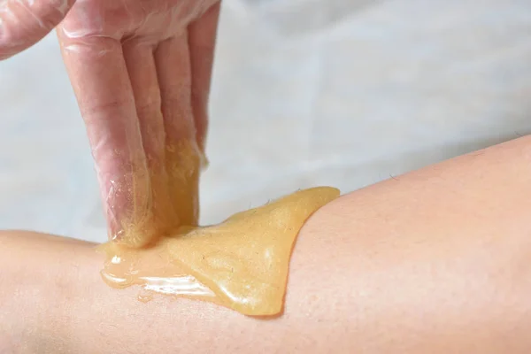 stock image Removing unnecessary hair on the legs. Procedure sugaring in a b