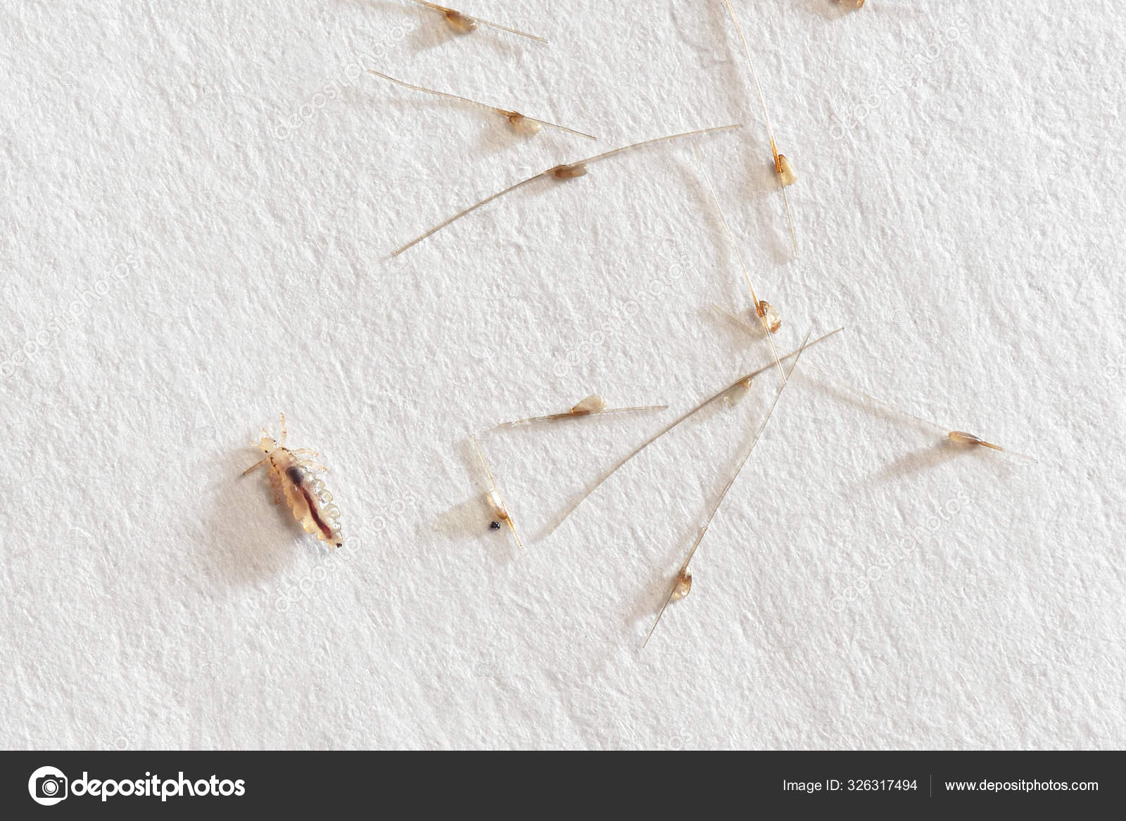 Louse and nits cocoons on white paper background Stock Photo by