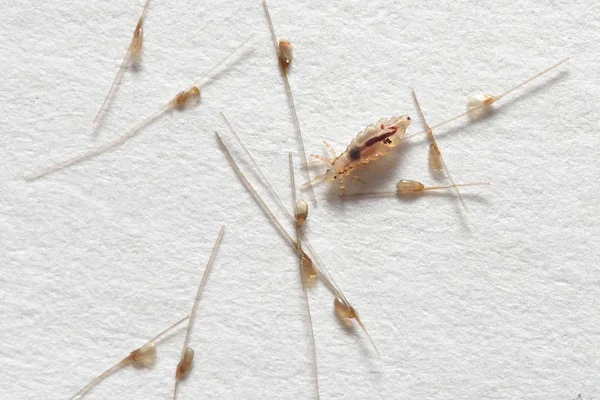 Louse and nits cocoons on white paper background — Stock Photo, Image