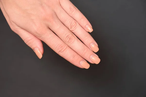 Gel Nails You Can See How Real Nails Have Grown — Stock Photo, Image