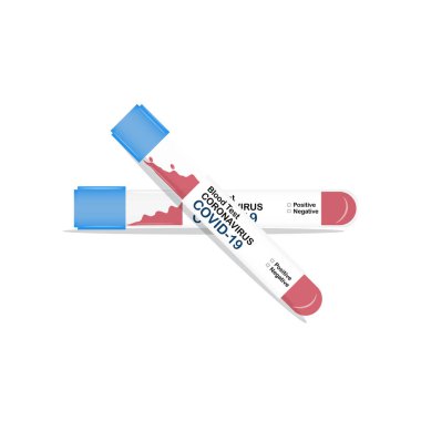 Elinde COVID-19 testi için kan örneği olan bir tüp var. Yeni hızla yayılan Coronavirus Covid-19 için pozitif test sonuçları