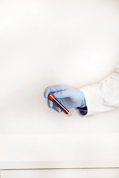 Hands holding a blood test tube with blue gloves on a white background, health concept — 스톡 사진