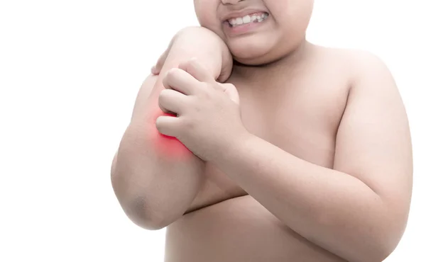 Zwaarlijvige vet jongen krassen op de jeuk met de hand. jeuk op geïsoleerde wh — Stockfoto