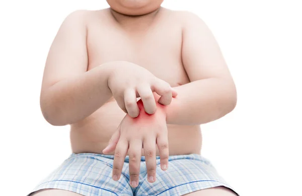 Obeso menino gordo coçar a coceira com a mão. comichão isolada — Fotografia de Stock