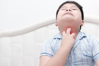 Asya obez çocuk yatağa el ile kaşıntı çizik