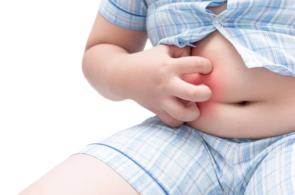 Obese fat boy scratch the itch with hand on belly — Stock Photo, Image