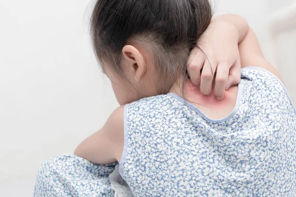 Asiático chica rascar la picazón con la mano — Foto de Stock