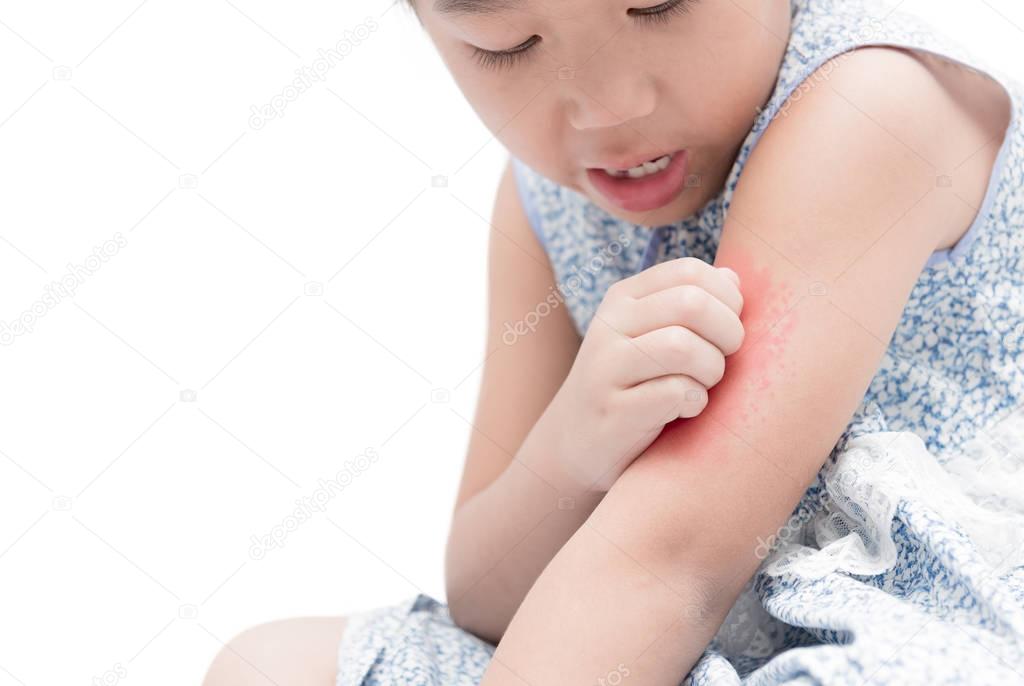 asian girl scratch the itch with hand her arm because of mosquit