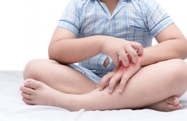 obez şişman çocuk el ile kaşıntı çizik 