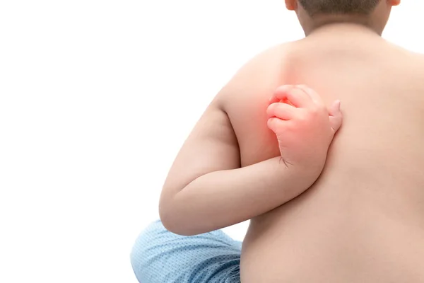 Problema de saúde.Menino gordo obeso coçando as costas — Fotografia de Stock