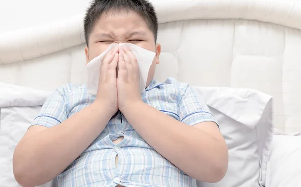 Gripe. Niño obeso tiene alergia a la nariz — Foto de Stock