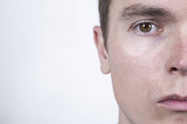 Yüzünde kederin ifadesi ve gözyaşı dolu gözleriyle yarım bir adam..