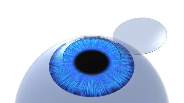 Illustrazione Dell Occhio Con Patta Corneale Isolato Bianco Rendering Immagine Stock