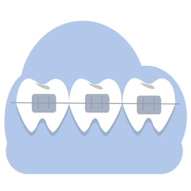 Diş telleri vektör illüstrasyonlu. Ortodontik, dişçi, tıbbi danışman. Sağlık hizmetleri.