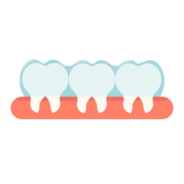 口腔の歯の矯正のための見えないブレース。整形外科学的概念ストックベクトル図。白い背景に歯と歯茎が分離された装置、物体. — ストックベクタ