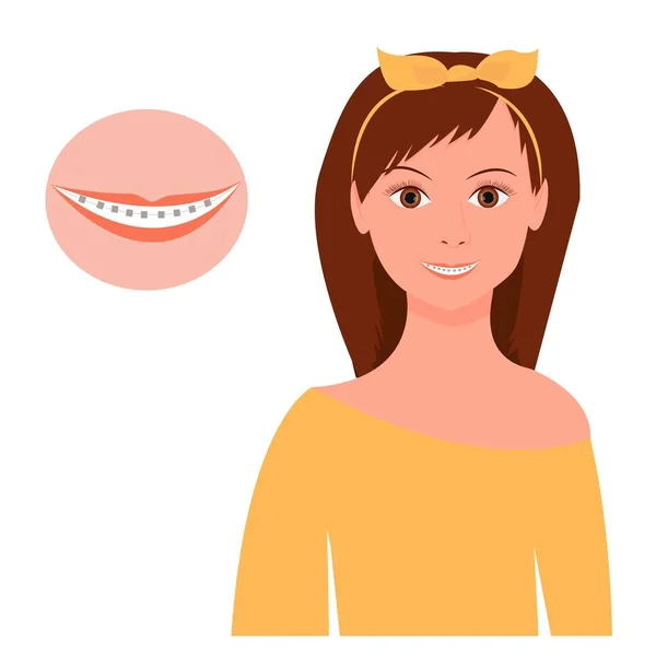 Portrait de jolie femme souriante avec bretelles isolées sur fond blanc illustration vectorielle. Graphisme, stomatologie, dentisterie, orthodontie, soins de santé — Image vectorielle