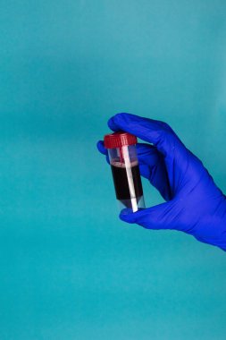Elin üzerinde kan olan bir test tüpü tutuyor. Coronavirus 2019-ncov