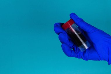 Elin üzerinde kan olan bir test tüpü tutuyor. Coronavirus 2019-ncov