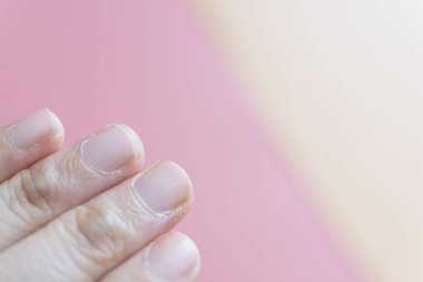 Gerçek kesme çivi üst görünümü 