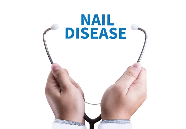 Doença do prego Infecção fúngica nas unhas Mão, Dedo com ônicho — Fotografia de Stock