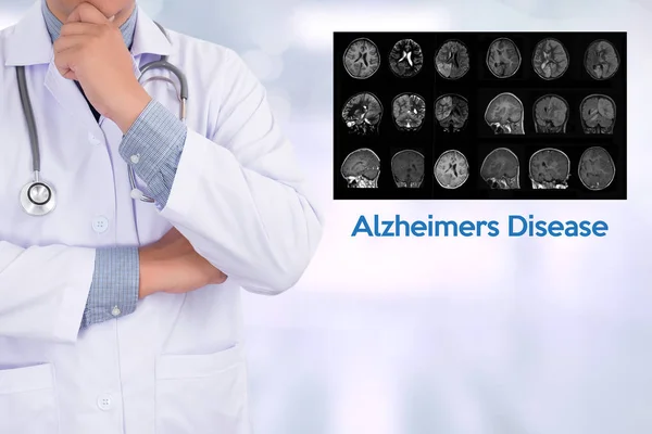 Концепція хвороб Альцгеймера, дегенеративні захворювання мозку Паркін — стокове фото