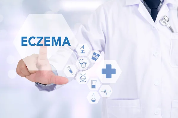 ECZEMA дерматит экзема кожи пациента, Проблема со многими — стоковое фото