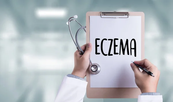 ECZEMA дерматит экзема кожи пациента, Проблема со многими — стоковое фото