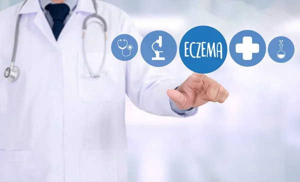 ECZEMA дерматит экзема кожи пациента, Проблема со многими — стоковое фото