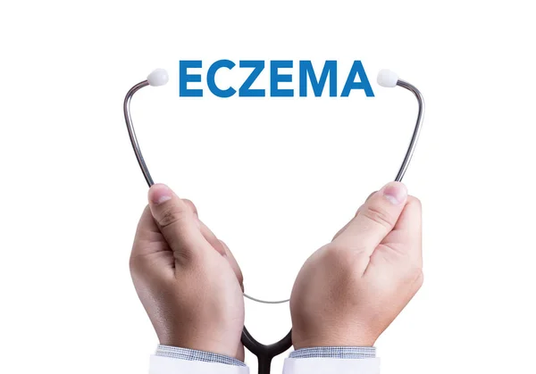 ECZEMA dermatitis eczema skin of patient , The problem with many — Stock Photo, Image