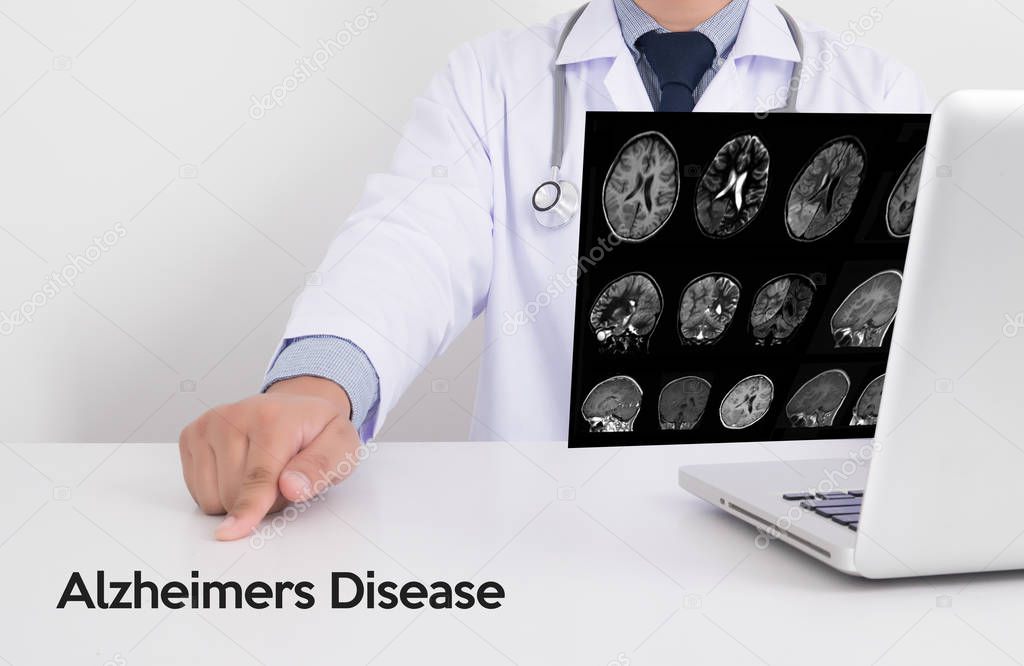  Alzheimers Disease concept , Brain degenerative diseases Parkin