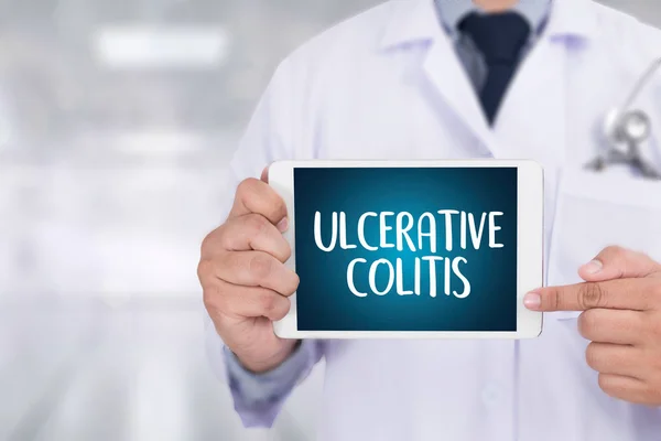 ULCERATIVE COLITIS Kesehatan konsep dokter modern — Stok Foto