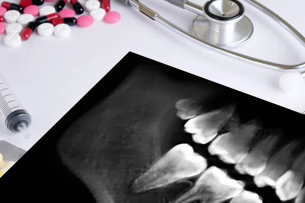 Dental röntgen läkare holding och tittar och hälso-och medicin — Stockfoto