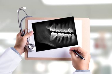 Holding ve seyir diş Röntgeni çekecek doktor ve Sağlık Tıp