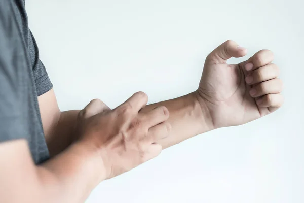 Itchy  arms scratching  Healthcare And Medicine Health problem — Stock Photo, Image