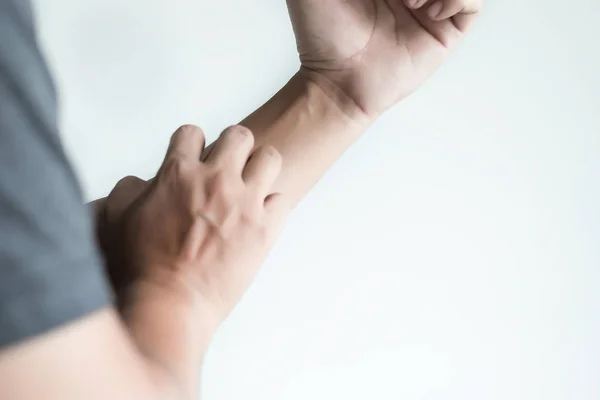 Itchy  arms scratching  Healthcare And Medicine Health problem — Stock Photo, Image
