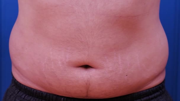 A man hits his fat belly in slow motion. Close-up. 120 fps — Stock Video