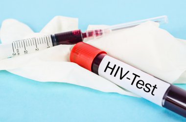 Tarama testi için HIV testi için örnek kan.