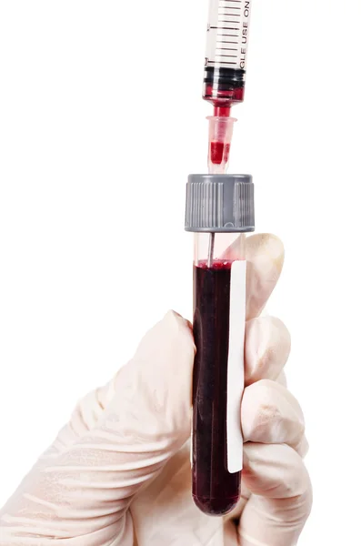 Médecin de la main tenant échantillon de sang pour test dans le tube sanguin de n — Photo