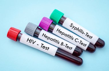 IV, HCV, HBV and shyphilis. clipart