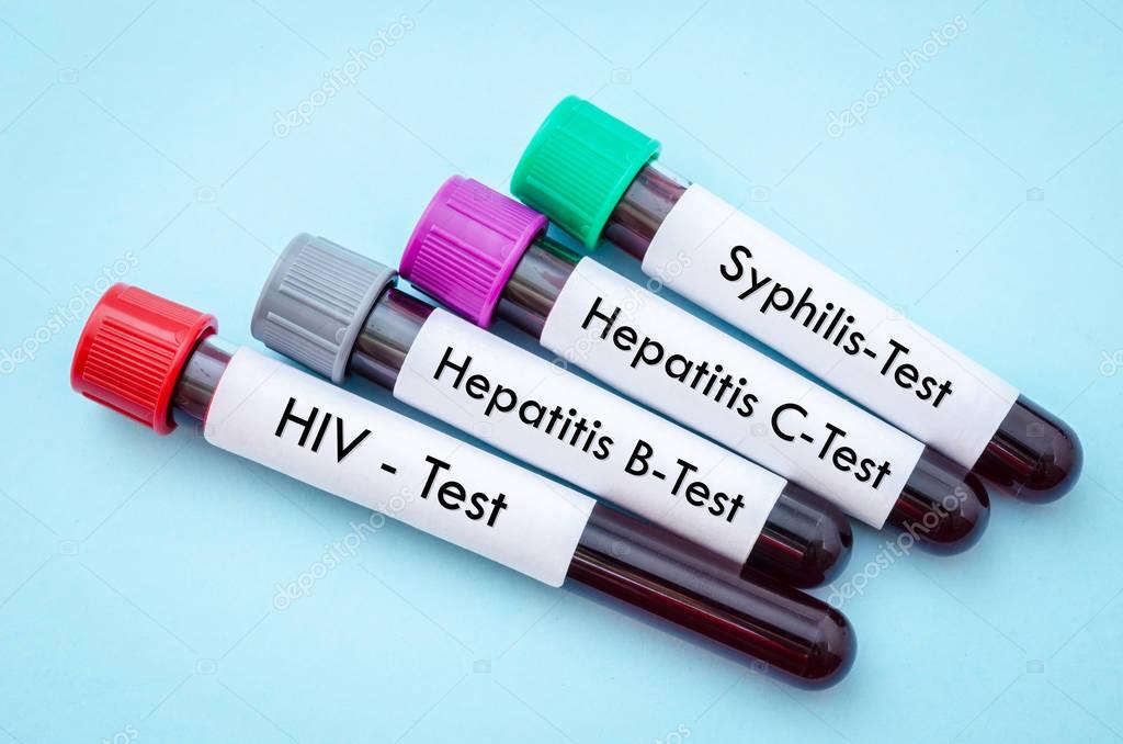 IV, HCV, HBV and shyphilis.