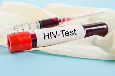 Tarama testi için HIV testi için örnek kan.
