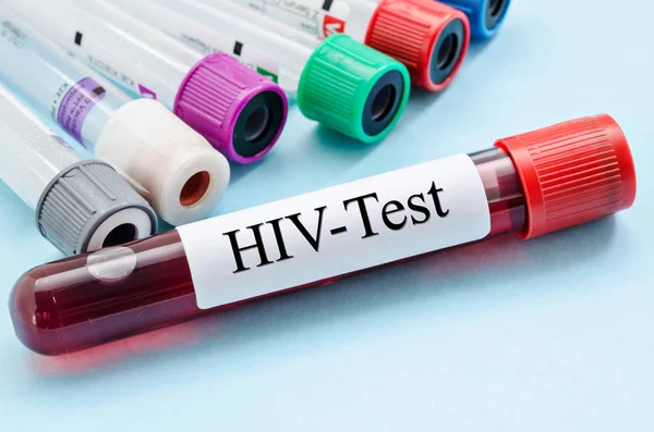 Stickprovet blod samling röret med Hiv test etikett. — Stockfoto