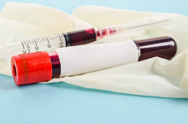 Sangue da amostra para teste de triagem e seringa . — Fotografia de Stock