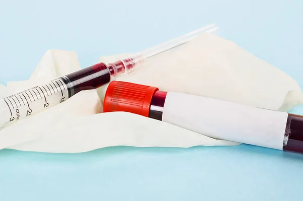 Sample blood for screening test and syringe on glove. — Stock Photo, Image