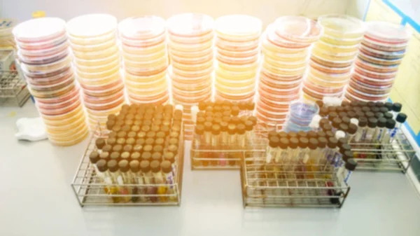 Próbki krwi tube i agar krwi w laboratorium badań. — Zdjęcie stockowe