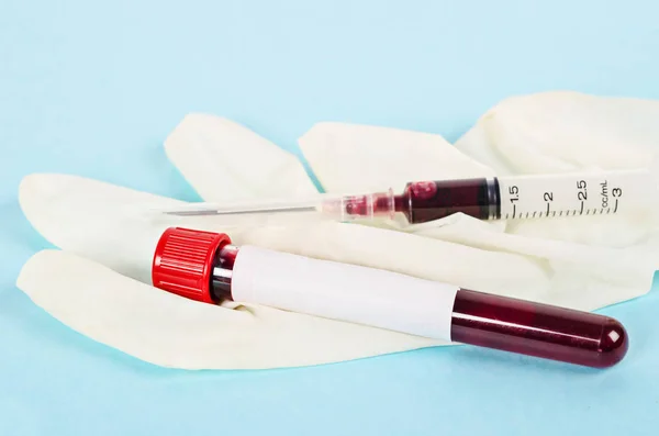 Blood sample in tube for testing. — Stock Photo, Image