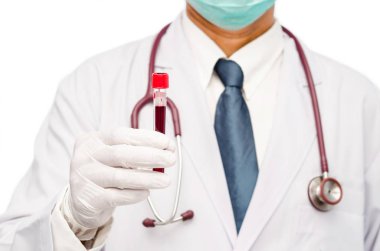 Tüp kan ile tutarak eldiven elinde doktor.