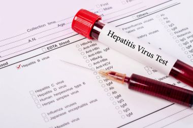 Dünya hepatit gün kavramı.