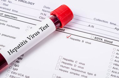 Dünya hepatit gün kavramı.