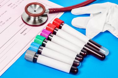 Vakum kan tüpü örnek kanla kümesi